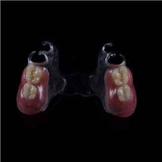 Izņemama akrila daļēja protēze