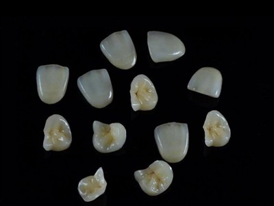 Kā izvēlēties labāko zobu līmi kroņiem: jaunākā rokasgrāmata