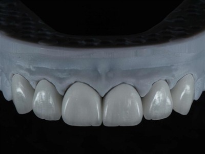 Kā izmantot ārpakalpojumus zobārstniecības laboratorijas tehniķim ārzemēs: vi...